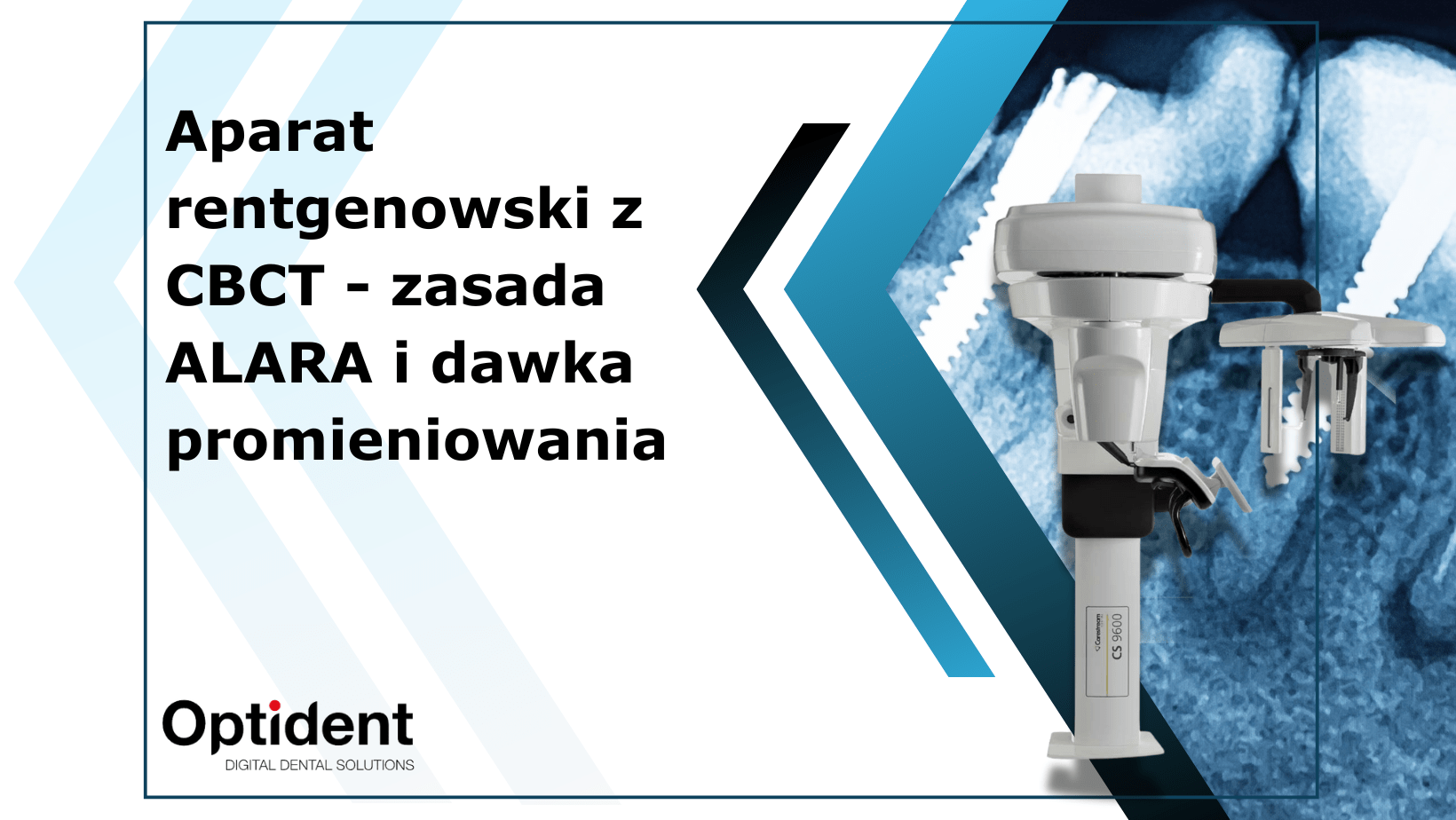 Aparat rentgenowski z CBCT - zasada ALARA i dawka promieniowania