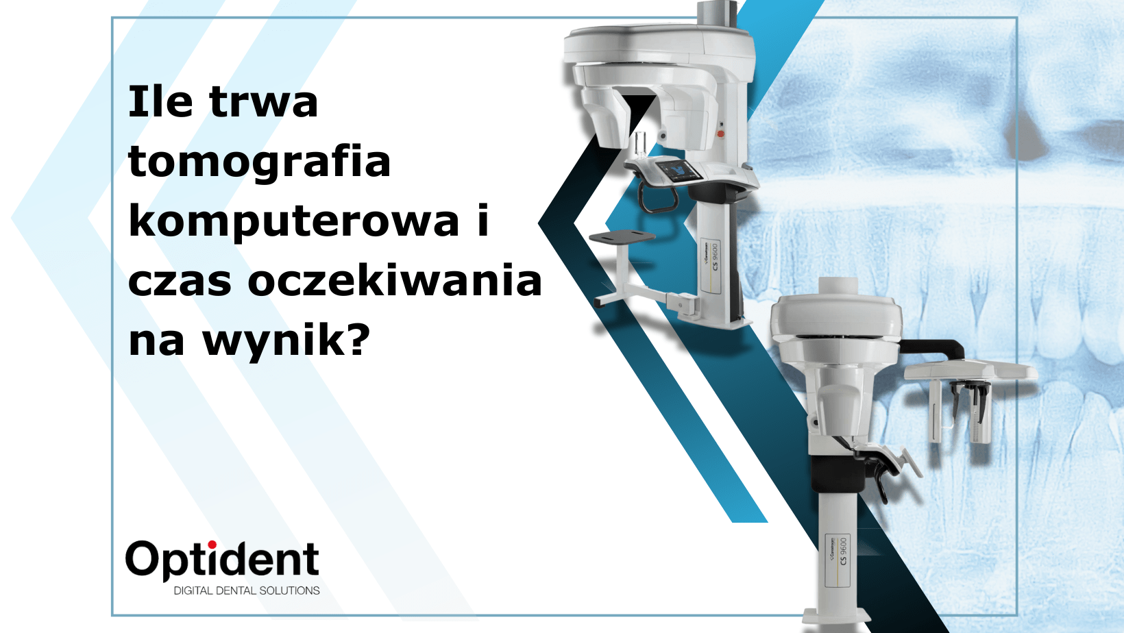Ile trwa tomografia komputerowa i czas oczekiwania na wynik