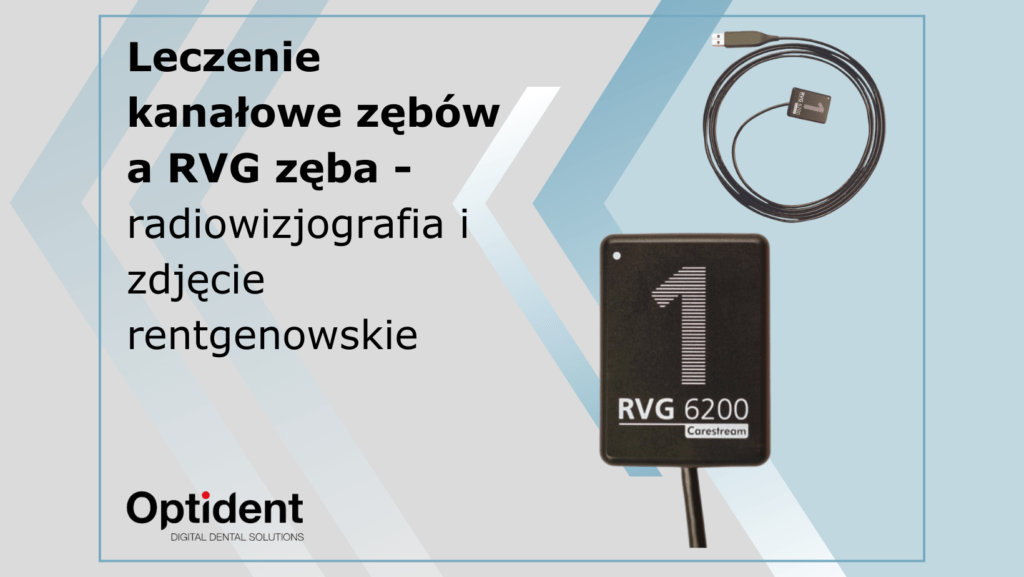Leczenie kanałowe zębów a RVG zęba - radiowizjografia i zdjęcie rentgenowskie