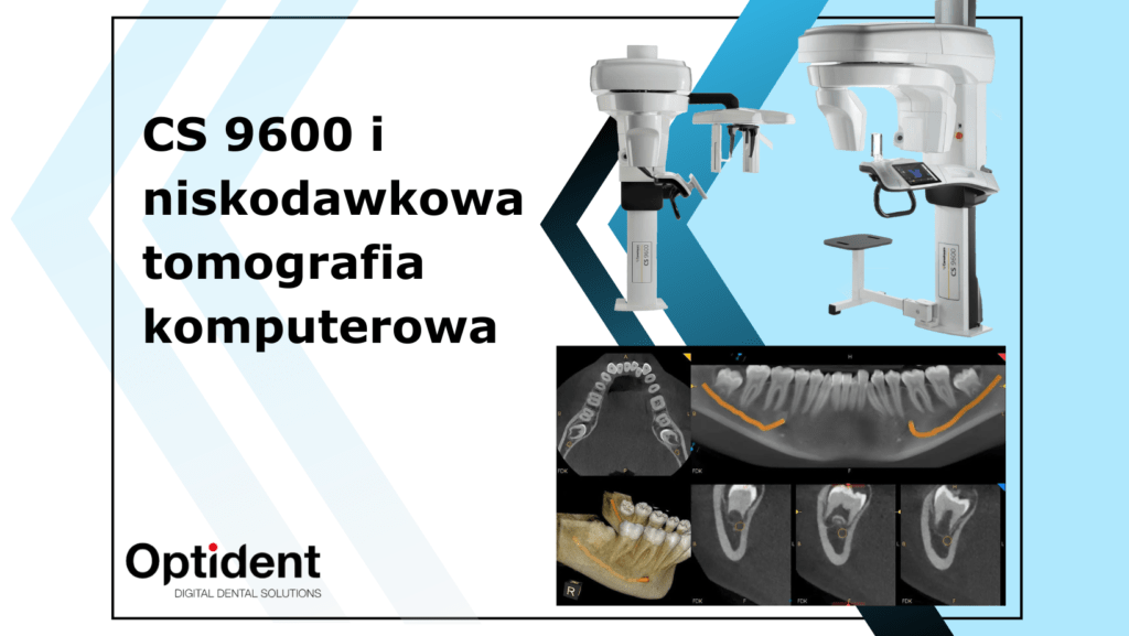 Obr. wyróżniający do bloga CS 9600 i niskodawkowa tomografia komputerowa