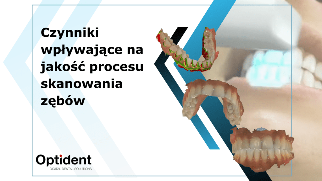 Obr. wyróżniający do bloga Czynniki wpływające na jakość procesu skanowania zębów