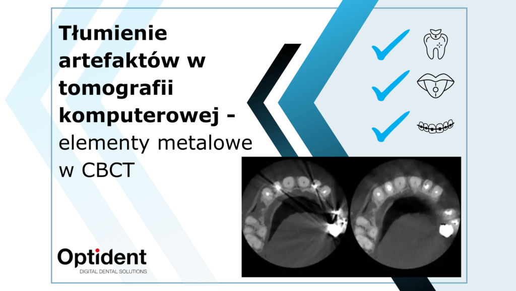 Tłumienie artefaktów w tomografii komputerowej - elementy metalowe w CBCT